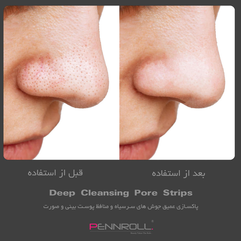 چسب پاک کننده بینی پنرول مدل PRD - Deep Blackhead Acne مجموعه 9 عددی - Image 3