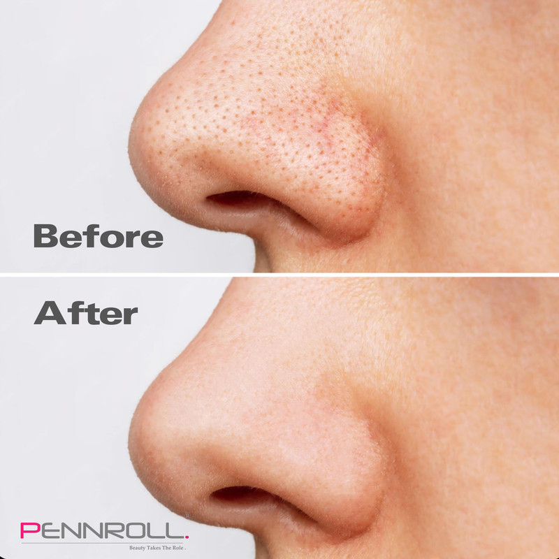 چسب پاک کننده بینی پنرول مدل PRD - Deep Blackhead Acne مجموعه 9 عددی - Image 7